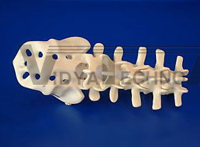 Spine Lumbar-Sac​ral L1/Sacrum Foam LFA